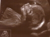 2008-11-03_21.hafta-profil